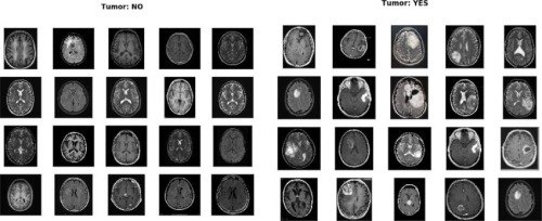 Dataset público de imágenes MRI